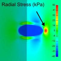 Graphic showing radial stress (kPa) of the human thoracic aorta